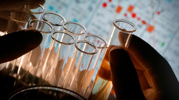 Kanados mokslininkai surado paprastą vaistą nuo vėžio, tačiau stambios farmacijos įmonės juo nesusidomėjo